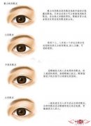 韩式自然双眼皮深怎么办 打造迷人大眼