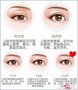 韩式无痛双眼皮效果和安全性如何 很容易具备立体感的眼睛