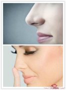 隆鼻手术失败有哪些危害？隆鼻失败后还能再次进行隆鼻吗？