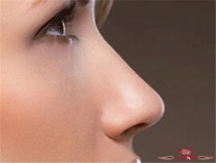 开刀式假体隆鼻哪些因素会影响效果 重现我们的美丽