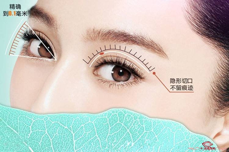 做韩式翘睫全切双眼皮专家讲解是怎么样的