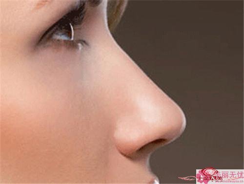 隆鼻手术应该怎么护理？